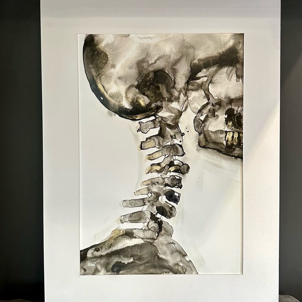Cervical XRay Fine Art Print 13"x19" - Picture 2 of 3